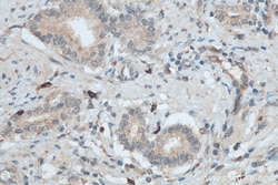 TGFB2/TGF-beta 2 Rabbit Polyclonal Antibody, Proteintech Unconjugated;