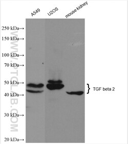 TGFB2/TGF-beta 2 Rabbit Polyclonal Antibody, Proteintech Unconjugated;
