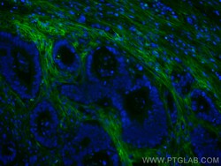 CoraLite Plus 488-conjugated TGFBI / BIGH3 Mouse Monoclonal Antibody, Proteintech