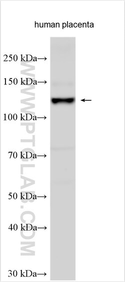 TGFBR3 Rabbit Polyclonal Antibody, Proteintech Unconjugated; 150 &mu;L:Antibodies,