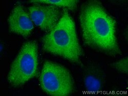TGM2 Mouse Monoclonal Antibody, Proteintech:Antibodies:Primary Antibodies