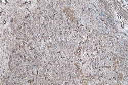 TGM2 Mouse Monoclonal Antibody, Proteintech:Antibodies:Primary Antibodies