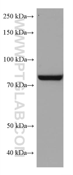 TGM2 Mouse Monoclonal Antibody, Proteintech:Antibodies:Primary Antibodies
