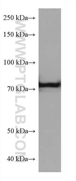 TGM2 Mouse Monoclonal Antibody, Proteintech:Antibodies:Primary Antibodies
