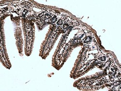 TIGAR Rabbit Polyclonal Antibody, Proteintech:Antibodies:Primary Antibodies