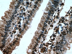 TIGAR Rabbit Polyclonal Antibody, Proteintech:Antibodies:Primary Antibodies