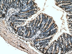 TIGAR Rabbit Polyclonal Antibody, Proteintech:Antibodies:Primary Antibodies