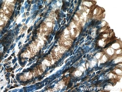 TIGAR Rabbit Polyclonal Antibody, Proteintech
