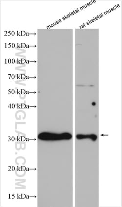 TIGAR Rabbit Polyclonal Antibody, Proteintech:Antibodies:Primary Antibodies