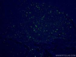 CoraLite Plus 488-conjugated TIMD4 Rabbit Polyclonal Antibody, Proteintech