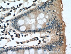 TK1 Mouse Monoclonal Antibody, Proteintech:Antibodies:Primary Antibodies