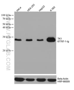 TK1 Mouse Monoclonal Antibody, Proteintech:Antibodies:Primary Antibodies