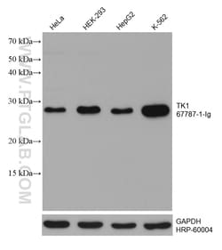 TK1 Mouse Monoclonal Antibody, Proteintech:Antibodies:Primary Antibodies