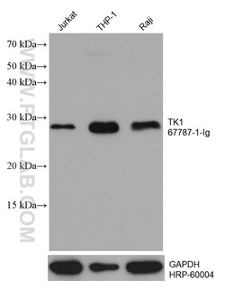 TK1 Mouse Monoclonal Antibody, Proteintech:Antibodies:Primary Antibodies