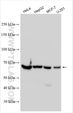 TKTL1 Rabbit Polyclonal Antibody, Proteintech Unconjugated; 20 &mu;L:Antibodies,