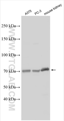 TM9SF4 Rabbit Polyclonal Antibody, Proteintech Unconjugated; 20 &mu;L:Antibodies,