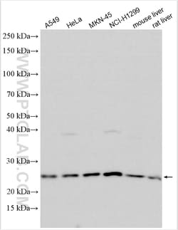TMED5 Rabbit Polyclonal Antibody, Proteintech 150 &mu;L | Buy Online | Proteintech | Fisher Scientific