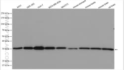 TMEM111 Rabbit Polyclonal Antibody, Proteintech Unconjugated; 150 &mu;L:Antibodies,