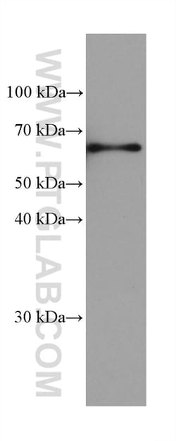 TMEM175 Mouse Monoclonal Antibody, Proteintech Unconjugated; 150 &mu;L:Anticuerpos