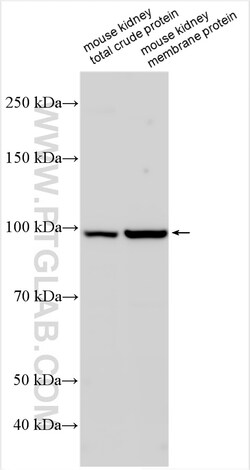 TMEM63B Rabbit Polyclonal Antibody, Proteintech Unconjugated; 20 &mu;L:Antibodies,