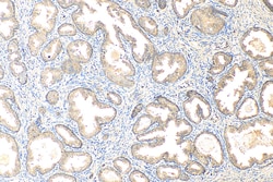 TMEM64 Rabbit Polyclonal Antibody, Proteintech:Antibodies:Primary Antibodies