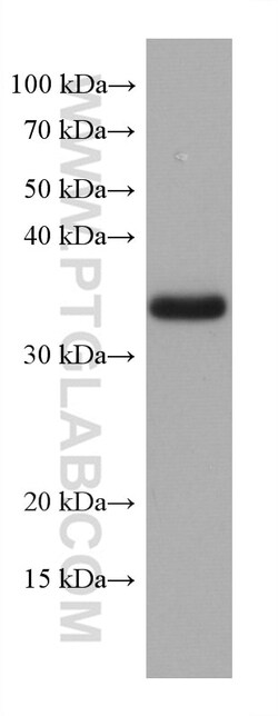 TMEM74 Mouse Monoclonal Antibody, Proteintech:Antibodies:Primary Antibodies