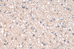 TMOD2 Mouse Monoclonal Antibody, Proteintech:Antibodies:Primary Antibodies