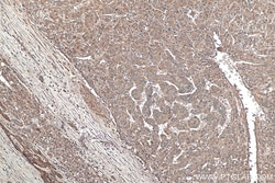 TNC/Tenascin-C Mouse Monoclonal Antibody, Proteintech 20 &mu;L | Buy Online | Proteintech | Fisher Scientific