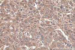 TNC/Tenascin-C Mouse Monoclonal Antibody, Proteintech 20 &mu;L | Buy Online | Proteintech | Fisher Scientific