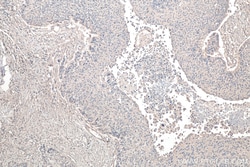 TNC/Tenascin-C Mouse Monoclonal Antibody, Proteintech 20 &mu;L | Buy Online | Proteintech | Fisher Scientific