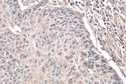 TNC/Tenascin-C Mouse Monoclonal Antibody, Proteintech 20 &mu;L | Buy Online | Proteintech | Fisher Scientific