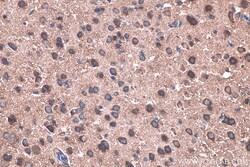 TNC/Tenascin-C Mouse Monoclonal Antibody, Proteintech 20 &mu;L | Buy Online | Proteintech | Fisher Scientific