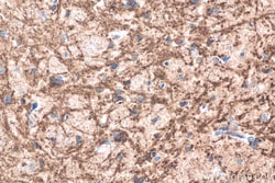 TNC/Tenascin-C Mouse Monoclonal Antibody, Proteintech 20 &mu;L | Buy Online | Proteintech | Fisher Scientific