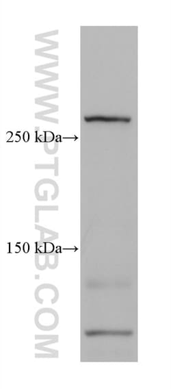 TNC/Tenascin-C Mouse Monoclonal Antibody, Proteintech 20 &mu;L | Buy Online | Proteintech | Fisher Scientific