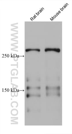 TNC/Tenascin-C Mouse Monoclonal Antibody, Proteintech 20 &mu;L | Buy Online | Proteintech | Fisher Scientific