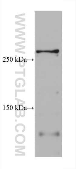 TNC/Tenascin-C Mouse Monoclonal Antibody, Proteintech 20 &mu;L | Buy Online | Proteintech | Fisher Scientific