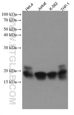 TNFAIP8 Mouse Monoclonal Antibody, Proteintech Unconjugated; 20 &mu;L:Antibodies,
