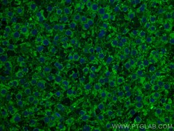CoraLite Plus 488-conjugated TNFR1/CD120a Mouse Monoclonal Antibody, Proteintech