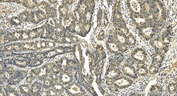 TOE1 Rabbit Polyclonal Antibody, Proteintech:Antibodies:Primary Antibodies