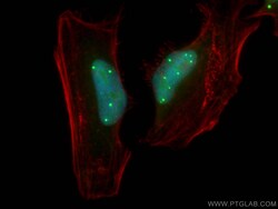 TOE1 Rabbit Polyclonal Antibody, Proteintech:Antibodies:Primary Antibodies