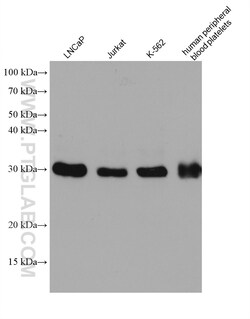 TOLLIP Mouse Monoclonal Antibody, Proteintech Unconjugated; 150 &mu;L:Antibodies,