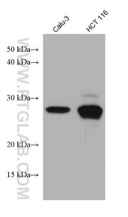 TPD52L2 Mouse anti-Human, Rat, Mouse, Clone: 3B3C6, Proteintech 150 &mu;L;
