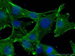 TPM3 Mouse Monoclonal Antibody, Proteintech:Antibodies:Primary Antibodies