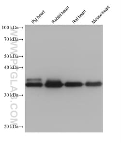 TPM3 Mouse Monoclonal Antibody, Proteintech:Antibodies:Primary Antibodies