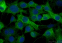 TPPP Mouse Monoclonal Antibody, Proteintech Unconjugated; 20 &mu;L:Antibodies,