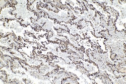 TPPP Mouse Monoclonal Antibody, Proteintech Unconjugated; 20 &mu;L:Antibodies,