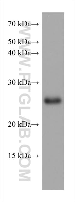 TPPP Mouse Monoclonal Antibody, Proteintech Unconjugated; 20 &mu;L:Antibodies,
