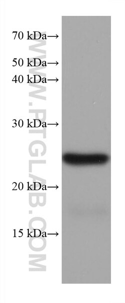 TPPP Mouse Monoclonal Antibody, Proteintech Unconjugated; 20 &mu;L:Antibodies,