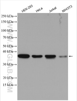 TRA2B Rabbit Polyclonal Antibody, Proteintech Unconjugated; 20 &mu;L:Antibodies,