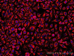 TRAP1 Mouse Monoclonal Antibody, Proteintech Unconjugated; 20 &mu;L:Antibodies,